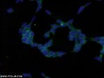 Thumbnail_MMS2 Rabbit anti-Human, Mouse, Rat, Polyclonal, Proteintech:Anticuerpos:Anticuerpos