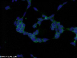 MMS2 Rabbit anti-Human, Mouse, Rat, Polyclonal, Proteintech:Anticuerpos:Anticuerpos