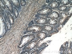 MMS2 Rabbit anti-Human, Mouse, Rat, Polyclonal, Proteintech:Anticuerpos:Anticuerpos