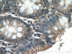 MMS2 Rabbit anti-Human, Mouse, Rat, Polyclonal, Proteintech:Anticuerpos:Anticuerpos