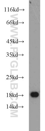 Thumbnail_MMS2 Rabbit anti-Human, Mouse, Rat, Polyclonal, Proteintech:Anticuerpos:Anticuerpos