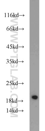 Thumbnail_MMS2 Rabbit anti-Human, Mouse, Rat, Polyclonal, Proteintech:Anticuerpos:Anticuerpos