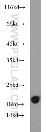 Thumbnail_MMS2 Rabbit anti-Human, Mouse, Rat, Polyclonal, Proteintech:Anticuerpos:Anticuerpos