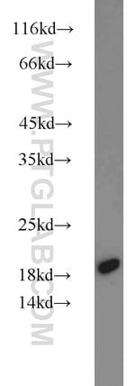Thumbnail_MMS2 Rabbit anti-Human, Mouse, Rat, Polyclonal, Proteintech:Anticuerpos:Anticuerpos