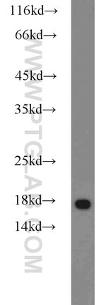 Thumbnail_MMS2 Rabbit anti-Human, Mouse, Rat, Polyclonal, Proteintech:Anticuerpos:Anticuerpos