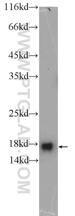 Thumbnail_MMS2 Rabbit anti-Human, Mouse, Rat, Polyclonal, Proteintech:Anticuerpos:Anticuerpos