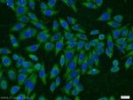 Thumbnail_MMS2 Rabbit anti-Human, Mouse, Rat, Polyclonal, Proteintech:Anticuerpos:Anticuerpos