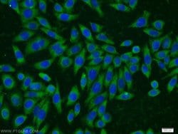 MMS2 Rabbit anti-Human, Mouse, Rat, Polyclonal, Proteintech:Anticuerpos:Anticuerpos
