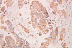 MMS2 Rabbit anti-Human, Mouse, Rat, Polyclonal, Proteintech:Anticuerpos:Anticuerpos