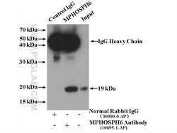 MPHOSPH6 Rabbit anti-Human, Mouse, Rat, Polyclonal, Proteintech 20 &mu;L | Buy Online | Proteintech | Fisher Scientific