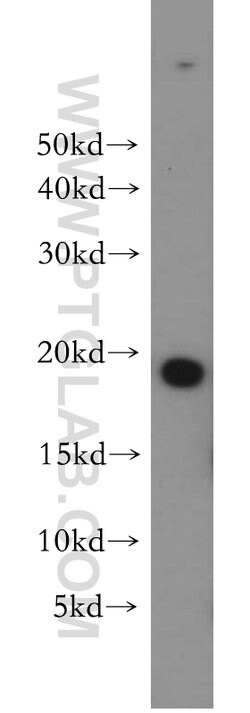 MPHOSPH6 Rabbit anti-Human, Mouse, Rat, Polyclonal, Proteintech 20 &mu;L | Buy Online | Proteintech | Fisher Scientific