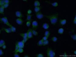 HO-1/HMOX1 Rabbit anti-Human, Mouse, Rat, Polyclonal, Proteintech:Antibodies:Primary
