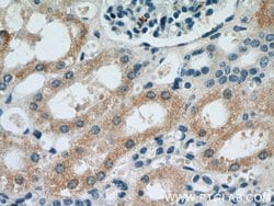 HO-1/HMOX1 Rabbit anti-Human, Mouse, Rat, Polyclonal, Proteintech