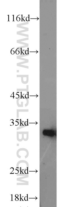 HO-1/HMOX1 Rabbit anti-Human, Mouse, Rat, Polyclonal, Proteintech:Antibodies:Primary