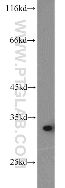 HO-1/HMOX1 Rabbit anti-Human, Mouse, Rat, Polyclonal, Proteintech:Antibodies:Primary