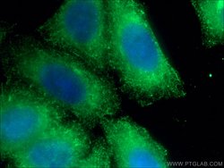 Cytokeratin 19 Rabbit anti-Human, Mouse, Polyclonal, Proteintech 150 &mu;L;