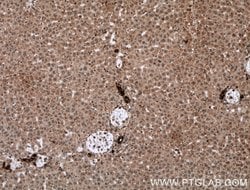 Cytokeratin 19 Rabbit anti-Human, Mouse, Polyclonal, Proteintech 150 &mu;L;