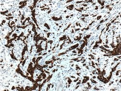 Cytokeratin 19 Rabbit anti-Human, Mouse, Polyclonal, Proteintech 150 &mu;L;