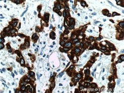 Cytokeratin 19 Rabbit anti-Human, Mouse, Polyclonal, Proteintech 150 &mu;L;