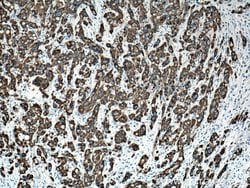 Cytokeratin 19 Rabbit anti-Human, Mouse, Polyclonal, Proteintech 150 &mu;L;
