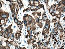 Cytokeratin 19 Rabbit anti-Human, Mouse, Polyclonal, Proteintech 150 &mu;L;