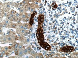 Cytokeratin 19 Rabbit anti-Human, Mouse, Polyclonal, Proteintech 150 &mu;L;