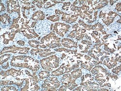 Cytokeratin 19 Rabbit anti-Human, Mouse, Polyclonal, Proteintech 150 &mu;L;