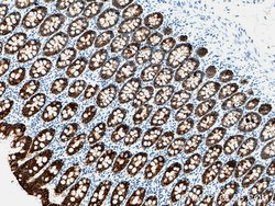 Cytokeratin 19 Rabbit anti-Human, Mouse, Polyclonal, Proteintech 150 &mu;L;