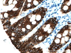 Cytokeratin 19 Rabbit anti-Human, Mouse, Polyclonal, Proteintech 150 &mu;L;