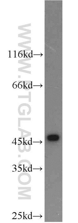 Cytokeratin 19 Rabbit anti-Human, Mouse, Polyclonal, Proteintech 150 &mu;L;