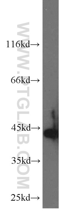 Cytokeratin 19 Rabbit anti-Human, Mouse, Polyclonal, Proteintech 150 &mu;L;