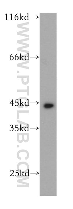 Cytokeratin 19 Rabbit anti-Human, Mouse, Polyclonal, Proteintech 150 &mu;L;