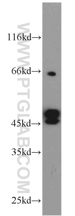 Cytokeratin 19 Rabbit anti-Human, Mouse, Polyclonal, Proteintech 150 &mu;L;