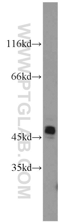 Cytokeratin 19 Rabbit anti-Human, Mouse, Polyclonal, Proteintech 150 &mu;L;