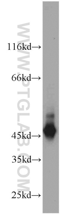 Cytokeratin 19 Rabbit anti-Human, Mouse, Polyclonal, Proteintech 150 &mu;L;
