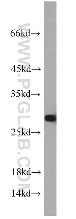 TPI1 Rabbit anti-Human, Mouse, Rat, Polyclonal, Proteintech:Antibodies:Primary