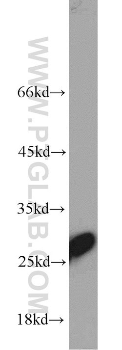 TPI1 Rabbit anti-Human, Mouse, Rat, Polyclonal, Proteintech:Antibodies:Primary