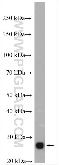 TPI1 Rabbit anti-Human, Mouse, Rat, Polyclonal, Proteintech:Antibodies:Primary