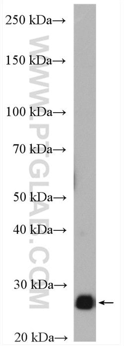 TPI1 Rabbit anti-Human, Mouse, Rat, Polyclonal, Proteintech:Antibodies:Primary