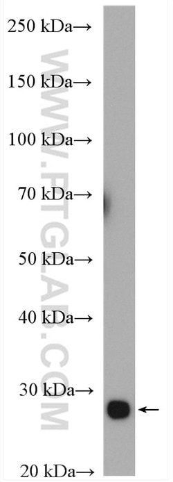 TPI1 Rabbit anti-Human, Mouse, Rat, Polyclonal, Proteintech:Antibodies:Primary