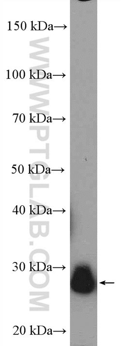 TPI1 Rabbit anti-Human, Mouse, Rat, Polyclonal, Proteintech:Antibodies:Primary