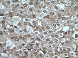 HINT1 Rabbit anti-Human, Mouse, Rat, Polyclonal, Proteintech:Antibodies:Primary