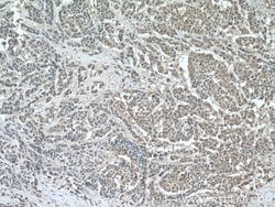HINT1 Rabbit anti-Human, Mouse, Rat, Polyclonal, Proteintech:Antibodies:Primary