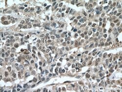 HINT1 Rabbit anti-Human, Mouse, Rat, Polyclonal, Proteintech:Antibodies:Primary