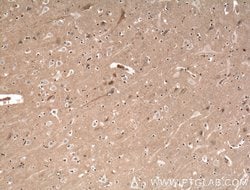 EPB41L3 Rabbit anti-Human, Mouse, Rat, Polyclonal, Proteintech:Antibodies:Primary