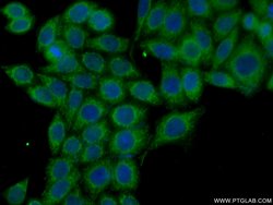 NRAS Rabbit anti-Human, Mouse, Rat, Polyclonal, Proteintech:Antibodies:Primary