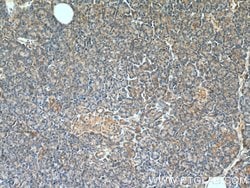 NRAS Rabbit anti-Human, Mouse, Rat, Polyclonal, Proteintech:Antibodies:Primary