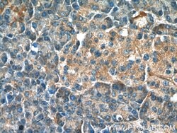 NRAS Rabbit anti-Human, Mouse, Rat, Polyclonal, Proteintech:Antibodies:Primary