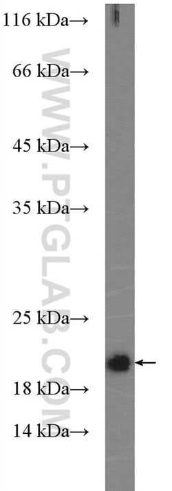 NRAS Rabbit anti-Human, Mouse, Rat, Polyclonal, Proteintech:Antibodies:Primary