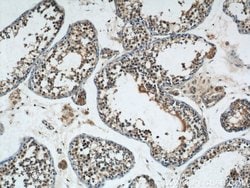 NRAS Rabbit anti-Human, Mouse, Rat, Polyclonal, Proteintech:Antibodies:Primary